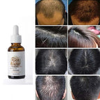 PurAect Japanese Fermented Rice Water Serum