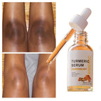 All-Natural Turmeric Serum for Glowing Skin – Perfect Beauty & Skincare Gift