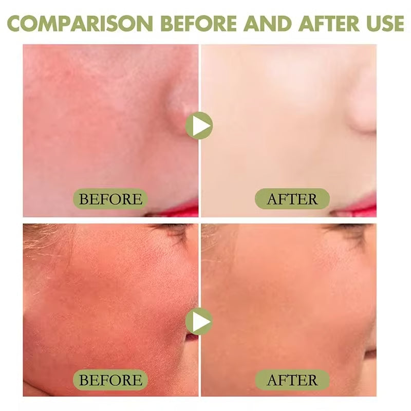 High Protection SPF Facial & Body Sunscreen Lightweight Non Greasy UV Shield