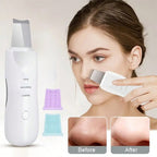 Deep Cleansing Facial Skin Scrubber | Face Spatula Exfoliator & Blackhead Pore Cleaner